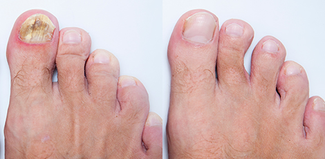 DERMATOLOŠKE 
INFORMACIJE
