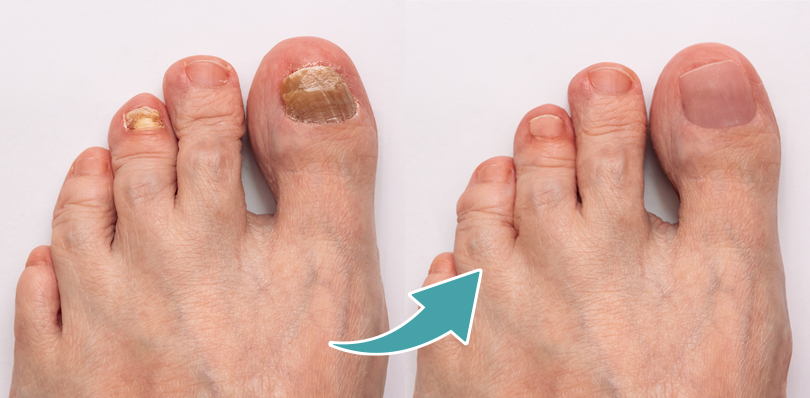 DERMATOLOŠKE 
INFORMACIJE
