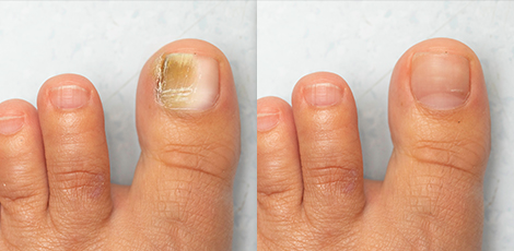 DERMATOLOŠKE 
INFORMACIJE
