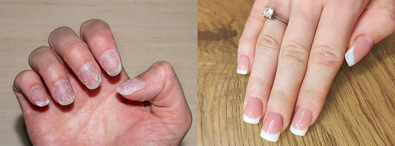 DERMATOLOŠKE 
INFORMACIJE
