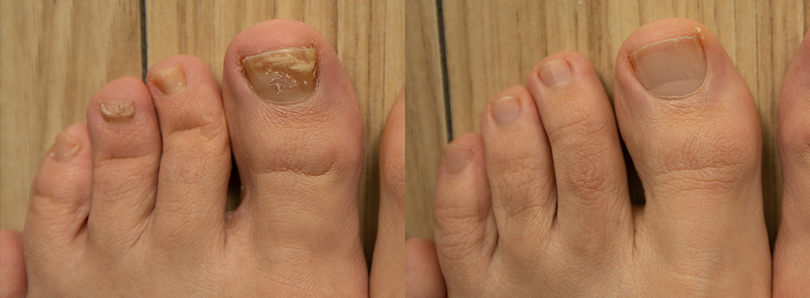 DERMATOLOŠKE 
INFORMACIJE
